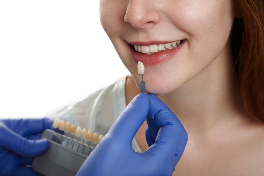 Dental professional matching veneer shades for a young female patient.