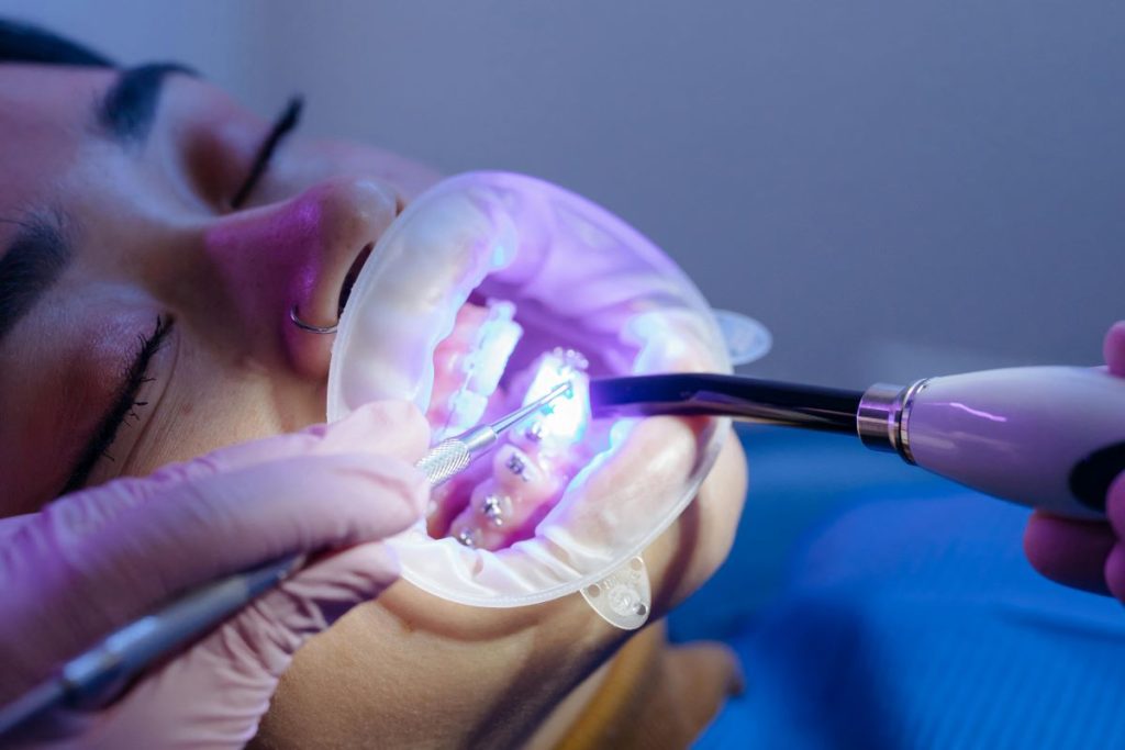 Dentist placing braces on a young woman’s teeth Orthodontics in Burlington