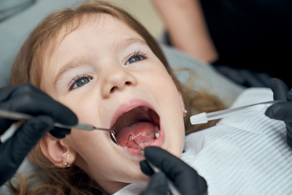 Child receiving dental sealants treatment in a clean dental clinic.