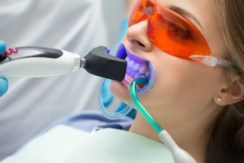 Dentist using a professional laser tool for teeth whitening on a patient wearing protective eyewear at Burlington Family Dentists.